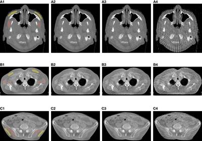 Virtual clinical trial-based study for clinical evaluation of projection-reduced low-dose cone-beam CT for image guided radiotherapy